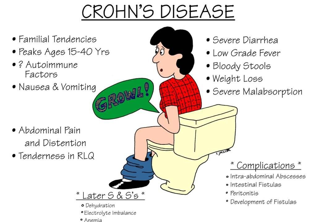 Crohn S Disease Natural Treatment Blog Crohn S Disease Natural Treatment Blog