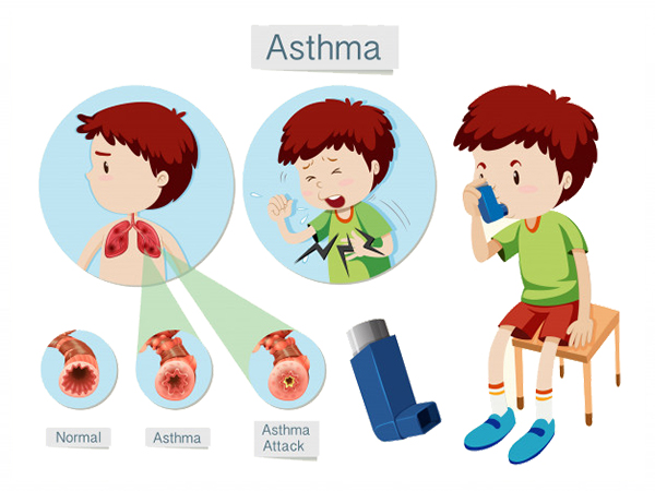 asthma symptoms