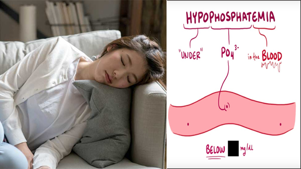 Signs and Symptoms of Hypophosphatemia