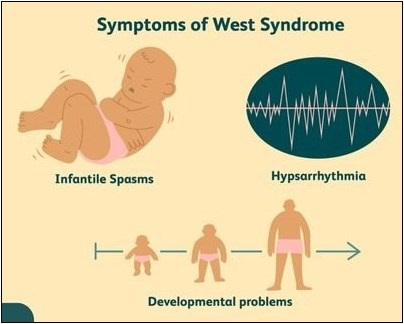 Herbal remedies for west syndrome