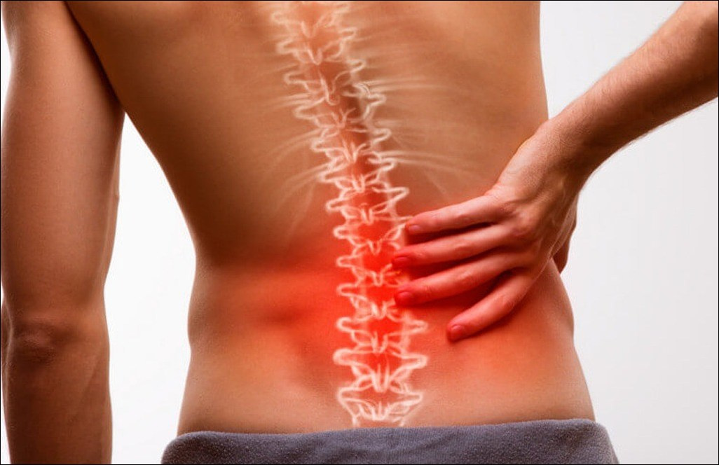 Herniated Disc Herniated Disc