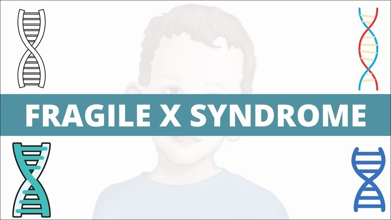 Fragile X Syndrome, (Martin-Bell syndrome) 