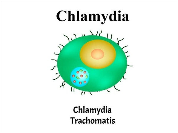 Chlamydia Trachomatis Chlamydia Trachomatis