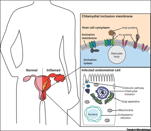 Chlamydia Trachomatis