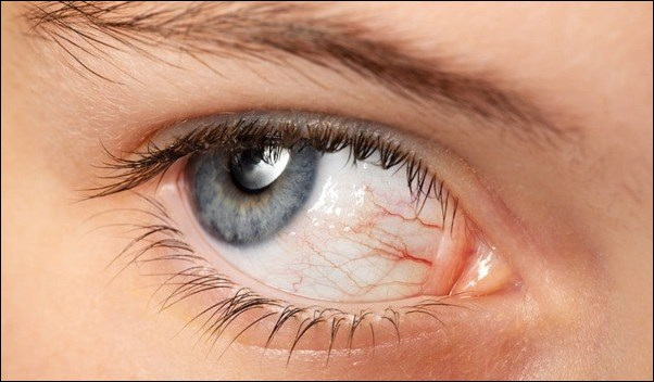 Ocular Surface Diseases 