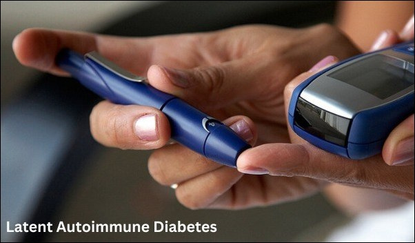 Latent Autoimmune Diabetes 