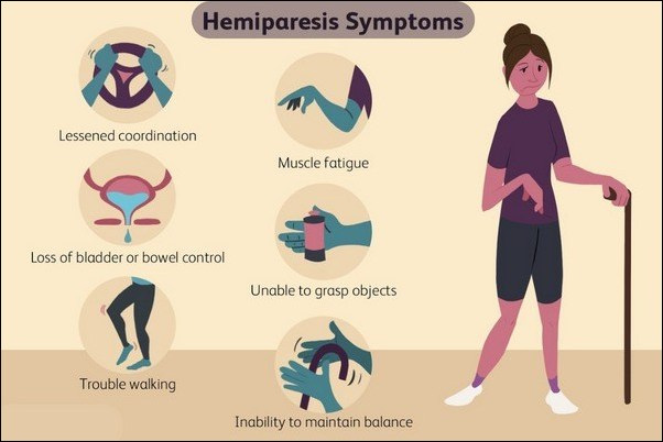 Hemapheresis